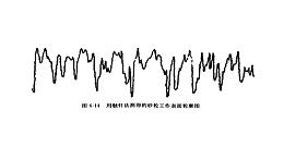 超声振动修整砂轮（一）